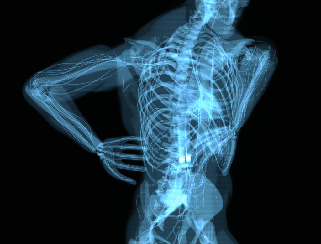 Comment savoir si un mal de dos est grave ?